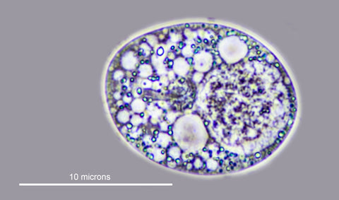 Yeast cell Phase contrast