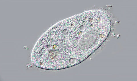 Paramecium caudatum surrounded by smaller ciliates, DIC microscopy 400X