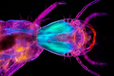 Water beetle larva Darkfield and polarizing microscopy 50X