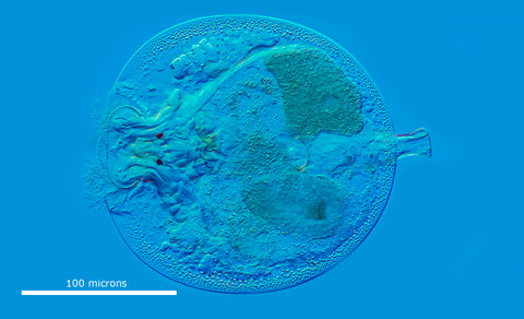 Rotifer Testudinella patina  - common name “Turtle rotifer” 400X DIC microscopy. Note the two eyes.