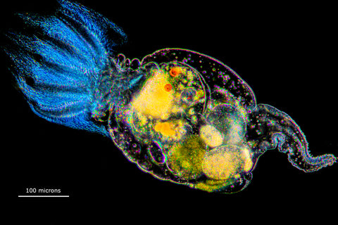 Rotifer Stephanoceros fimbriatus one of the most beautiful rotifers - Darkfield microscopy