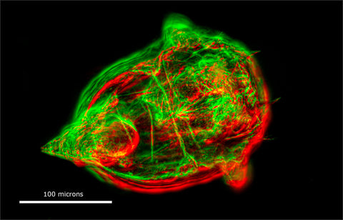 Rotifer Synchaeta pectinata by combined Darkfield and Rheinberg lighting