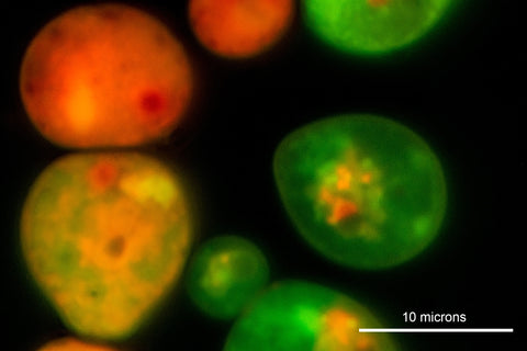 Yeast Cells staines