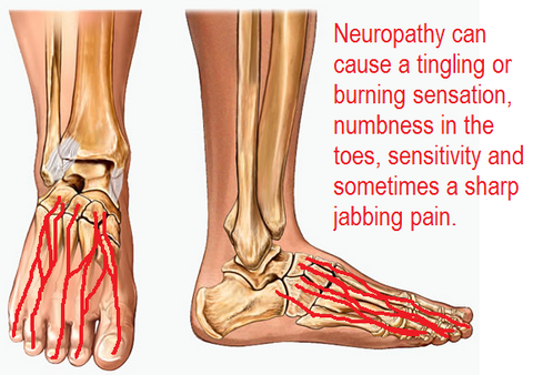 Z-CoiL Neuropathy Shoes can help pain 