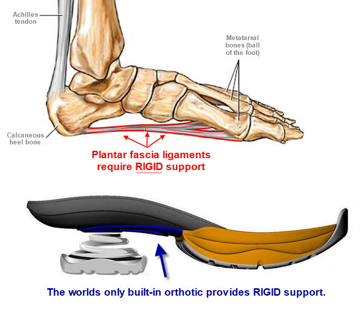 rigid orthotics for plantar fasciitis