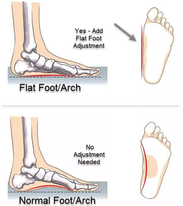 **ADJUSTMENT** NOT AN ACTUAL ITEM / Add for a Flat Foot or very low ar