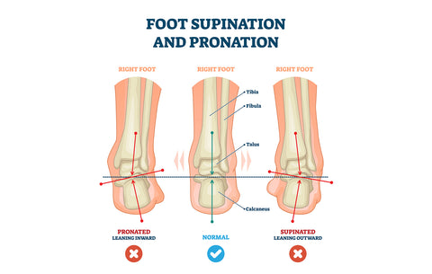 how to correct supination