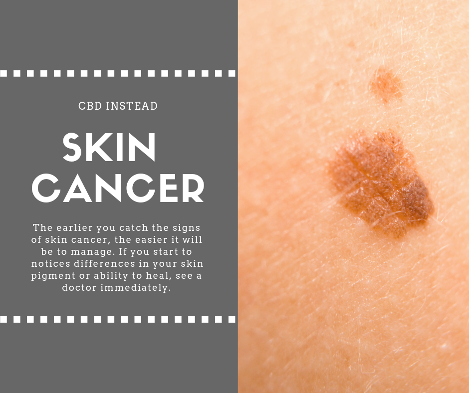 Skin Cancer Signs And Symptoms