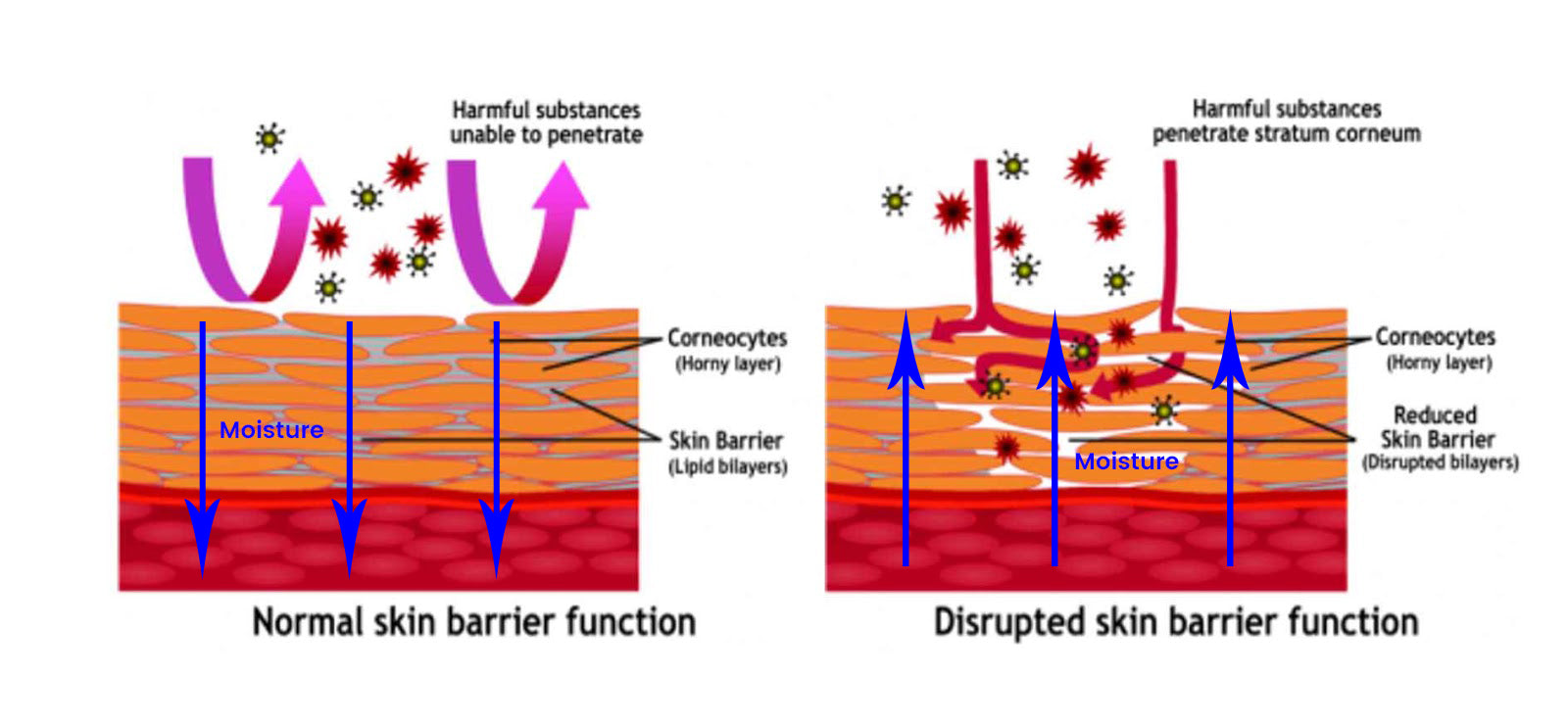 what_is_skin_barrier