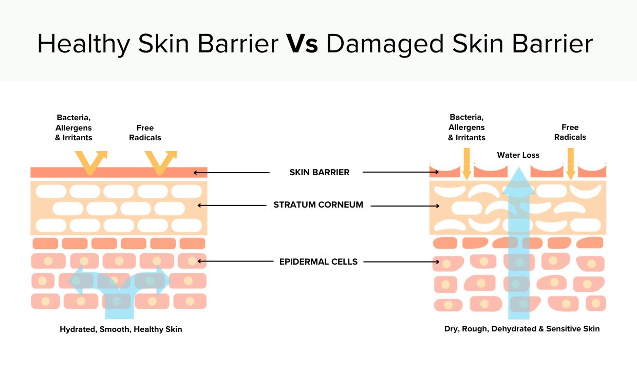 How to repair a damaged skin barrier
