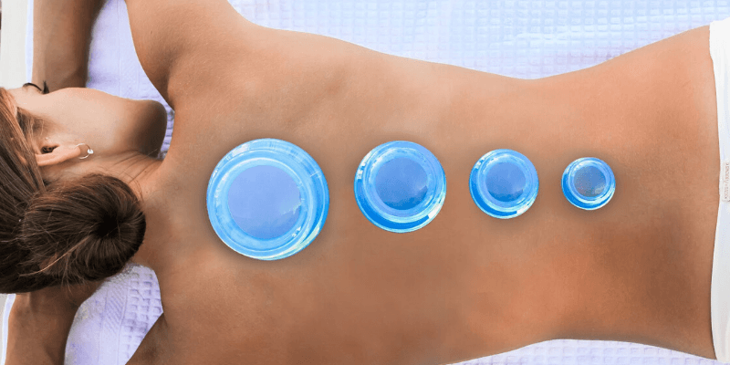 Wat is Cupping-Therapie? - Lure Essentials