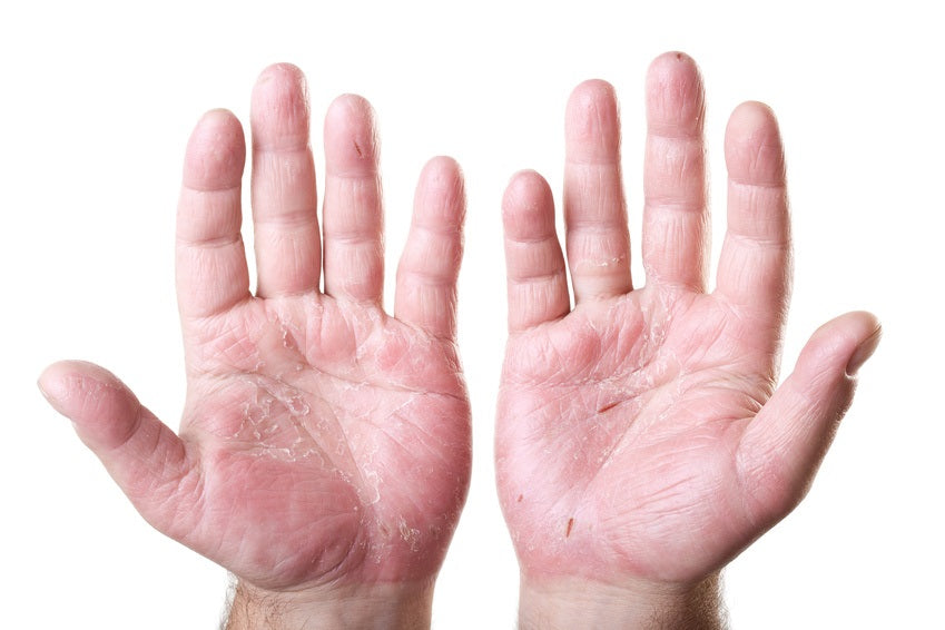 Why Washing Dishes by Hand May Lead to Fewer Allergies