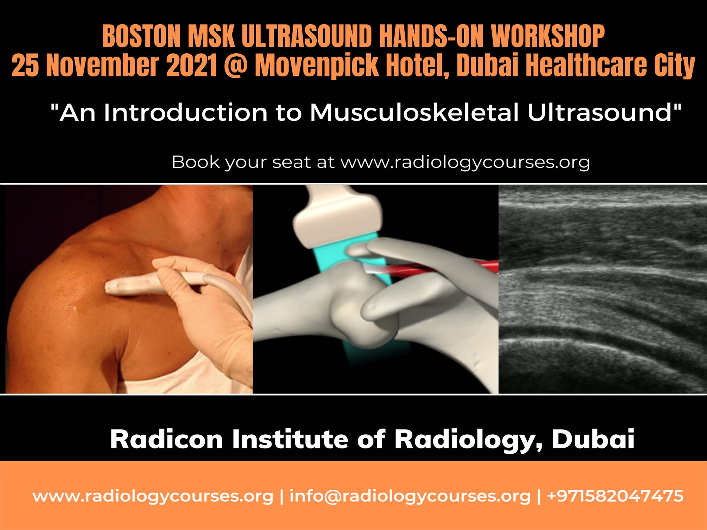 MSK Ultrasound, Musculoskeletal ultrasound course, Ultrasound joints