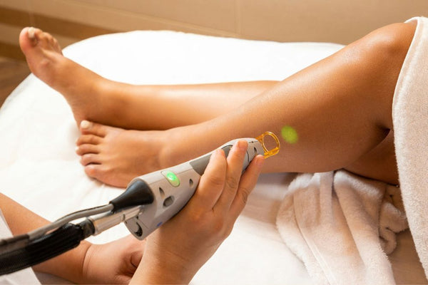 sugaring vs laser hair removal