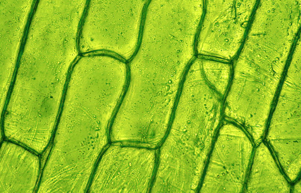 Plant cells under a microscope.