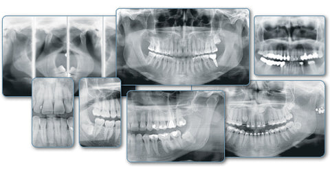 Dental Panoramic Systems Rotograph Prime