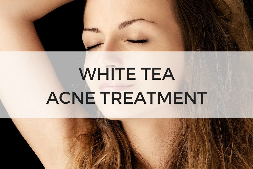 White Tea Acne Treatment