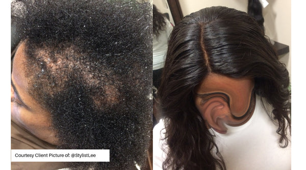 Before and after image of sew-in hair extension benefits - Hair transformation