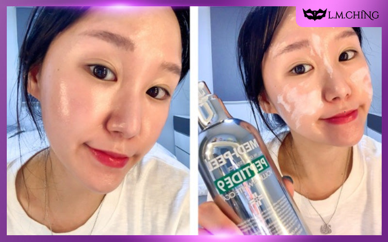 Personal Experience with Medi Peel Peptide 9 Volume Essence White Cica