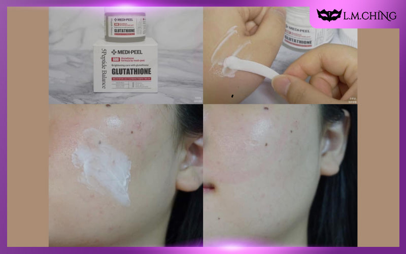 Personal Experience with Using Medi Peel Glutathione 600 White Cream