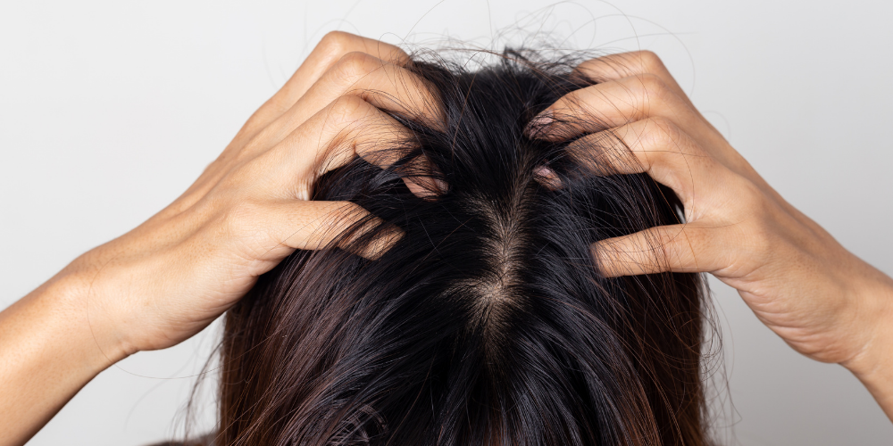 argan oil scalp health