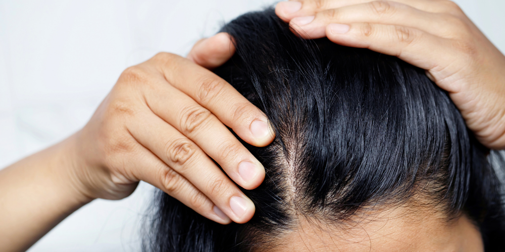 hair loss argan oil