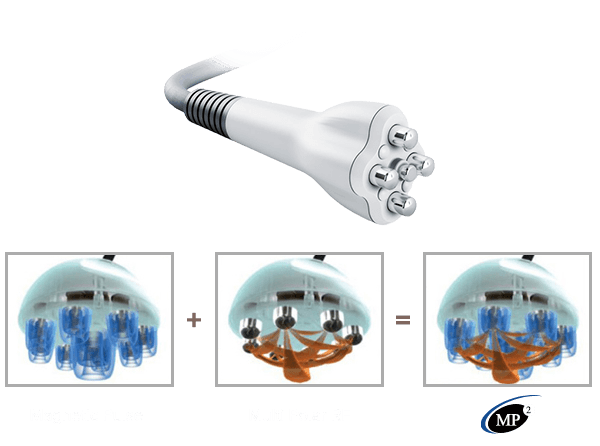 Venus Viva Multi-Polar RF Diamond Octi Applicator 2