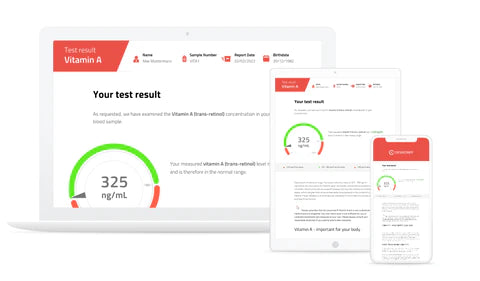 Results Vitamin A Test