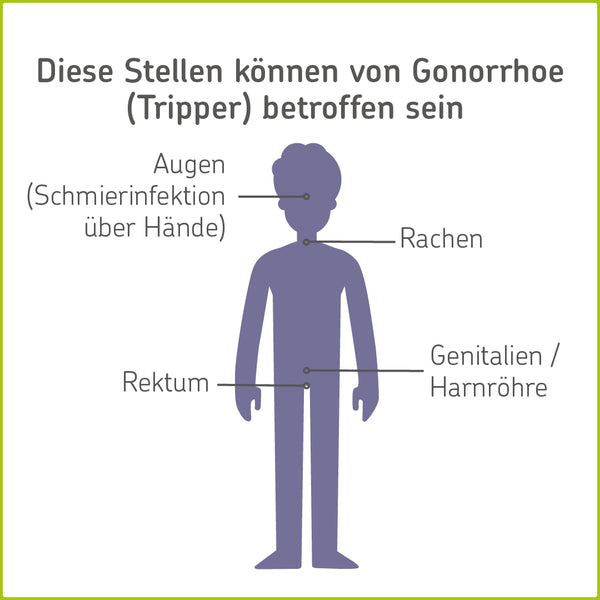 Infografik mit Stellen, die von Gonorrhoe betroffen sein können: Augen, Rachen, Rektum, Genitalien 