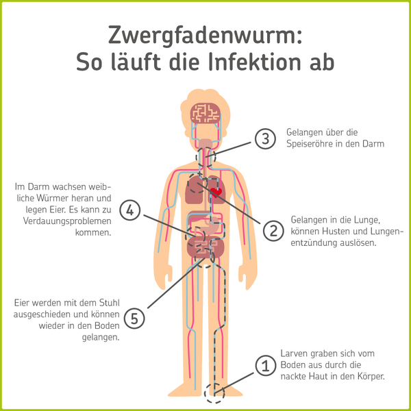 Infografik: Infektion mit dem Zwergfadenwurm