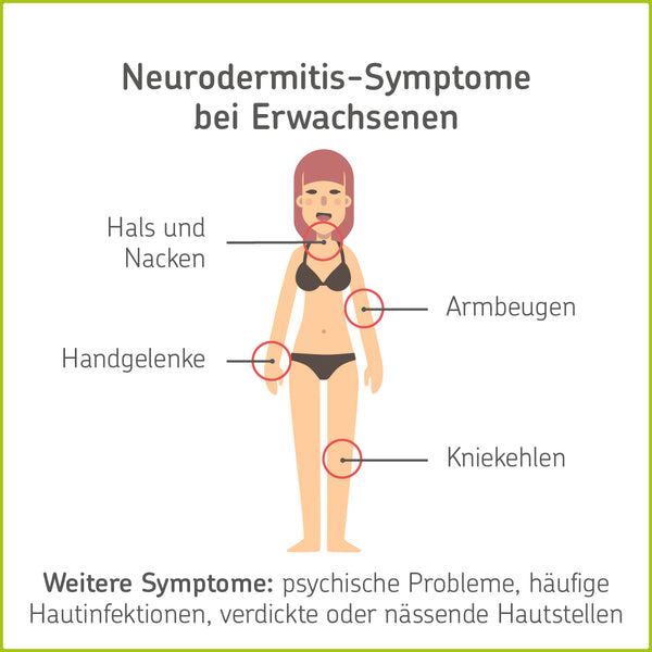 Infografik zu den Symptomen der Neuordermitis: Hautveränderungen an Hals und Nacken, Armbeugen, Handgelenken und Kniekehlen