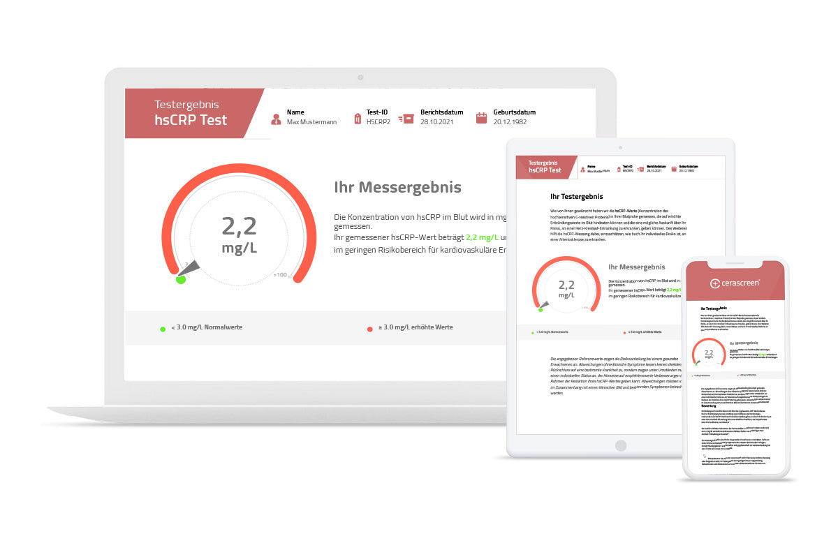 Ihr Testergebnis hsCRP Test