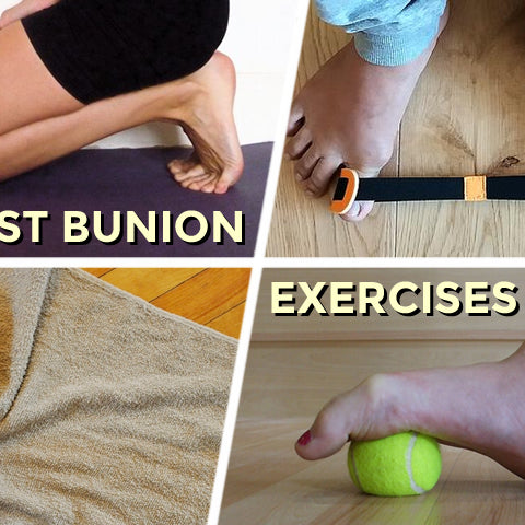 Bunions Advice | Best Treatments, Exercises, Recovery and Tips — Feet&Feet