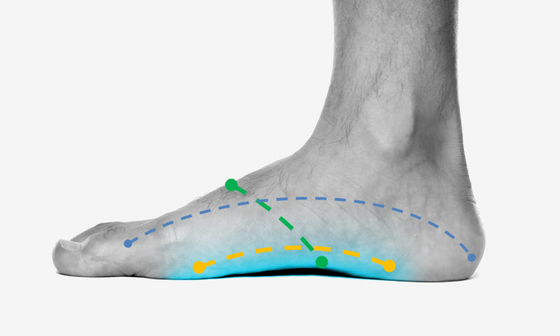 high arch feet pain from tied shoes