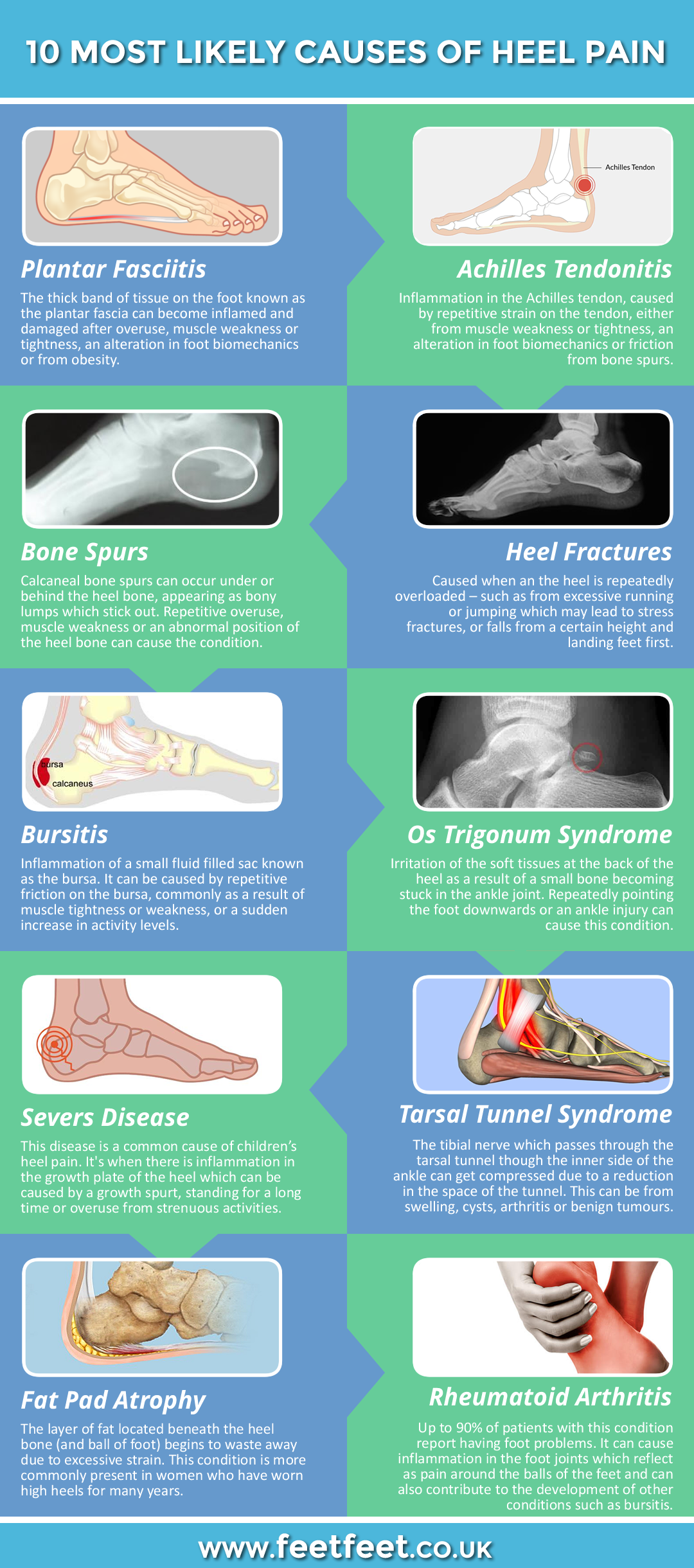 10 Most Likely Causes of Heel Pain