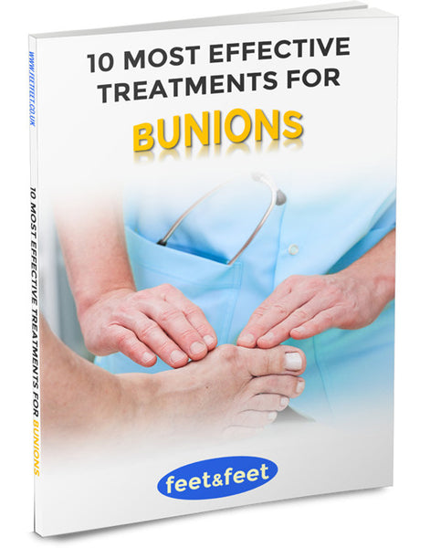 10 Most Effective Treatments For Bunions