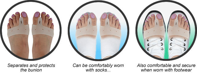 DuraFlex Gel Bunion Protection Sleeves