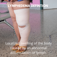 lymphedema supplement swelling