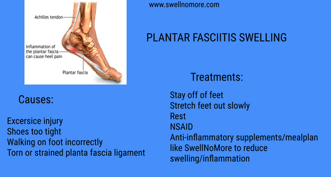 plantar fasciitis swelling