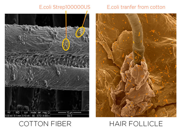 E.coli on cotton fiber and hair follicle
