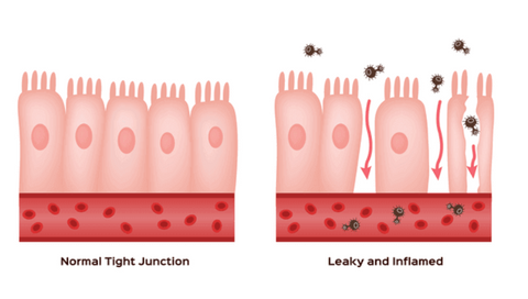 A visual of the tight junctions of your intestines