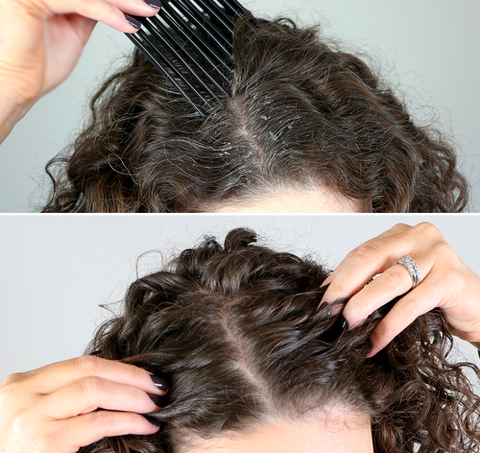 what are the main causes of scalp build up