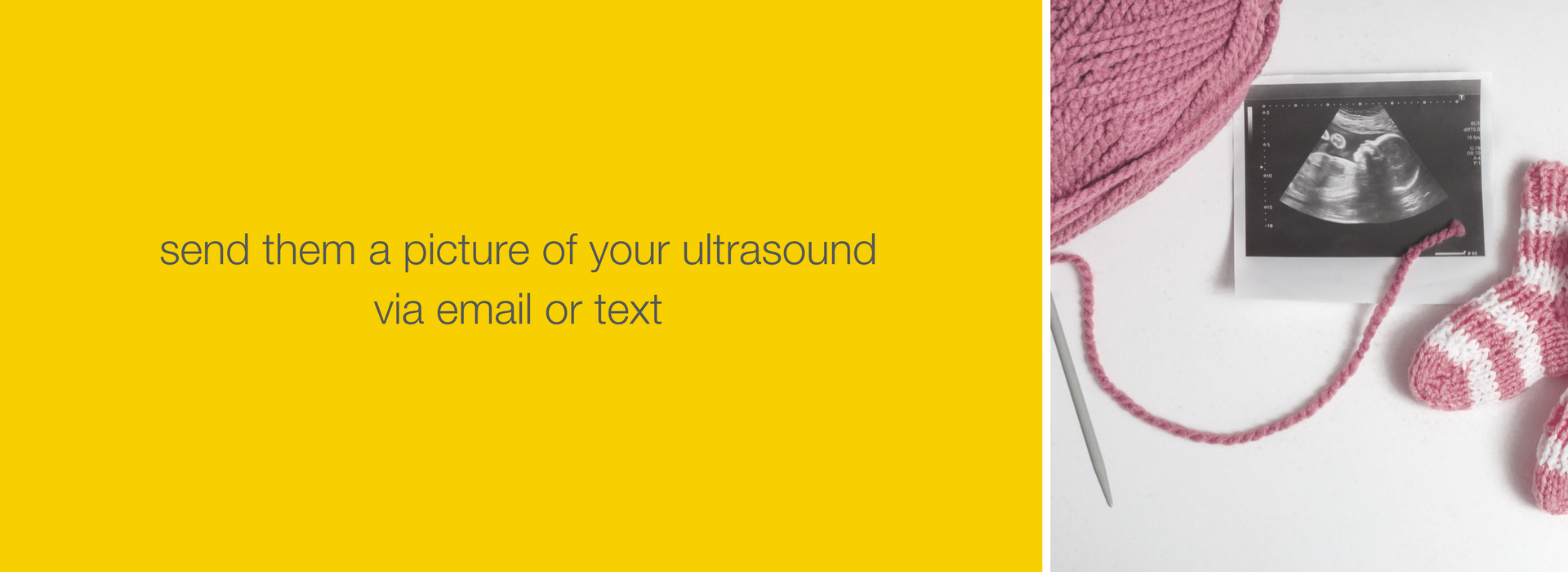 The first thing you want to do when you find out you’re expecting is to tell everyone you know. There are so many baby announcement ideas out there, it’s hard to narrow it down to just one. We’ve compiled the top ways to announce your pregnancy – creative ideas for your husband, for your family & for your friends. If this isn’t your first pregnancy, it’s a great idea to create an announcement with siblings (even with dog siblings too)!  Click to check it out! #BubziCo #NewMom #BabyReveal