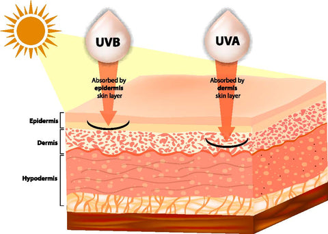 Diagram of sun damage to the skin barrier