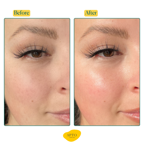 Close up images of a Caucasian Woman's face before and after using APTO Skincare's Turmeric Oil with Rosemary