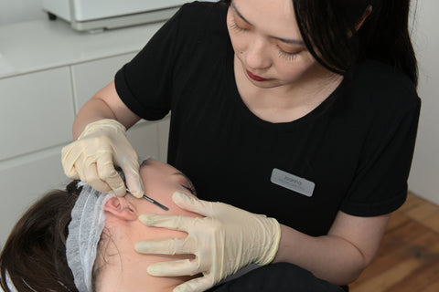 Epidermal Levelling 