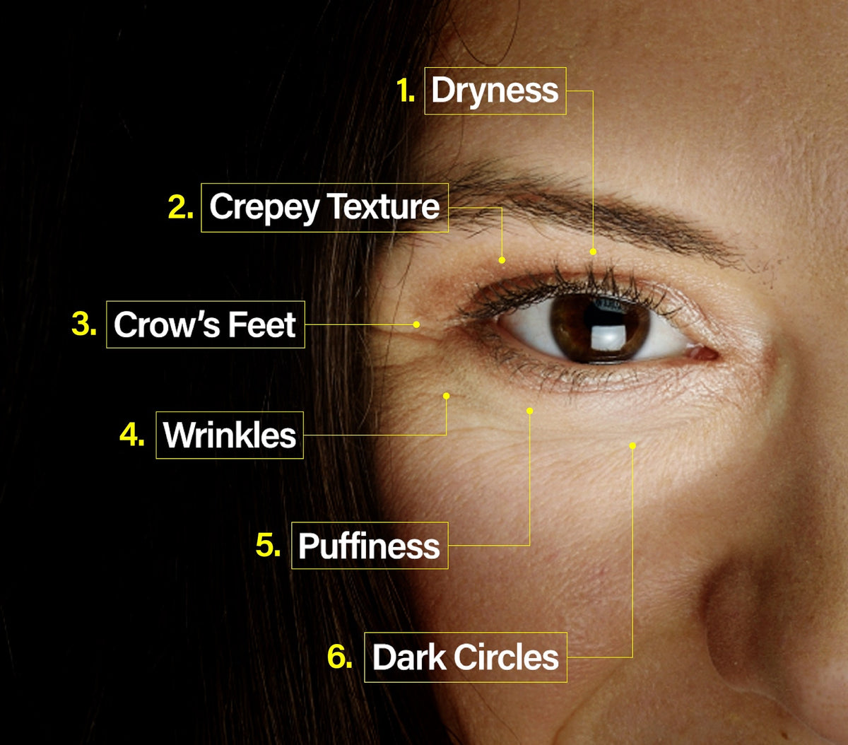 6 major signs of aging shown on an old woman close-up.