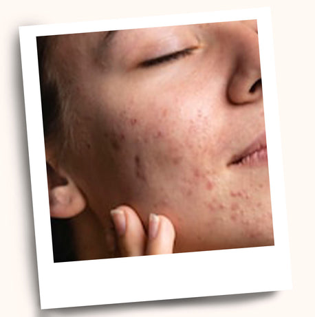 uneven and spotted.jpg__PID:5cbc97b4-1a1d-4a11-b64a-5378152665a6