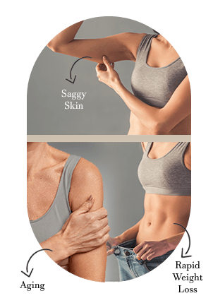 Saggy skin from aging or weight loss