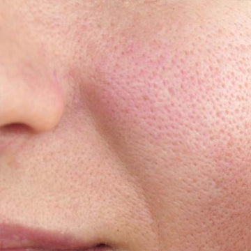 Large Pores